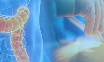 Center for Colorectal Disease of Arizona
